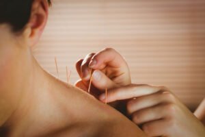 Dry Needling, Taping & Laser Therapy: New-Age Physiotherapy at ArthroRehab