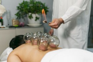 Best Cupping Therapy in Faridabad for Pain Relief & Muscle Recovery