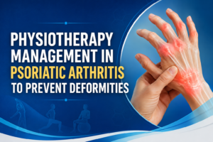 Physiotherapy Management in Psoriatic Arthritis to Prevent Deformities